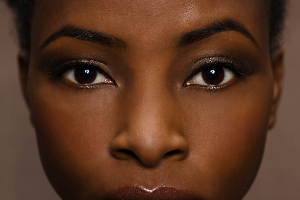 Woman Mocked for Her Skin Condition Stuns Everyone With Her New Radiant Beauty